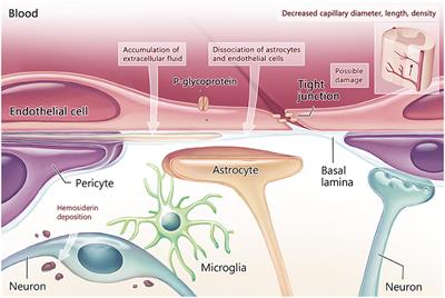 Breached Barriers: A Scoping Review of Blood-Central Nervous System Barrier Pathology in Amyotrophic Lateral Sclerosis